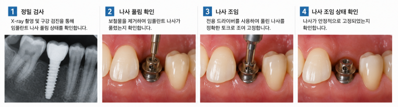임플란트 나사 풀림 확인 및 조임 과정을 보여주는 4단계 이미지. 정밀 검사, 나사 풀림 확인, 나사 조임, 나사 조임 상태 확인.